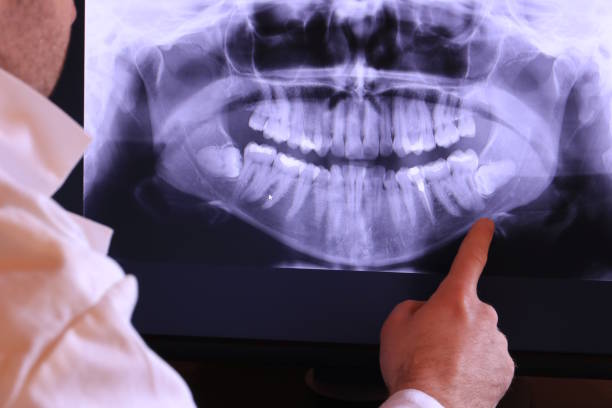 Best Broken or Cracked Tooth Emergency Dentist in Beacon Hill, WA