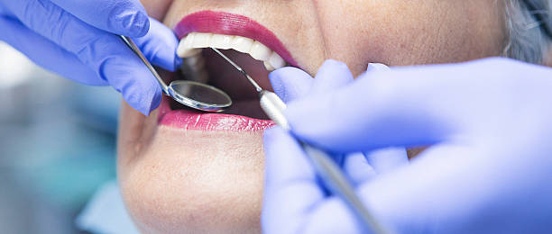 Best Broken or Cracked Tooth Emergency Dentist in Beacon Hill, WA